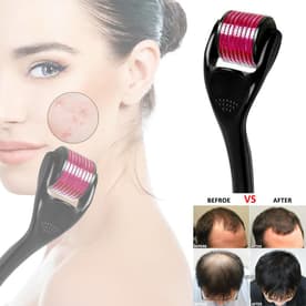 Derma Roller System 0.50 Mm With 540 Micro Needles